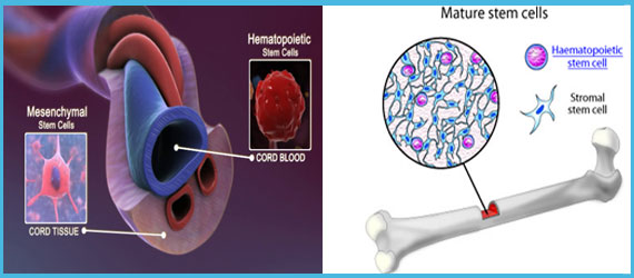 Bone Marrow Derived Stem Cells