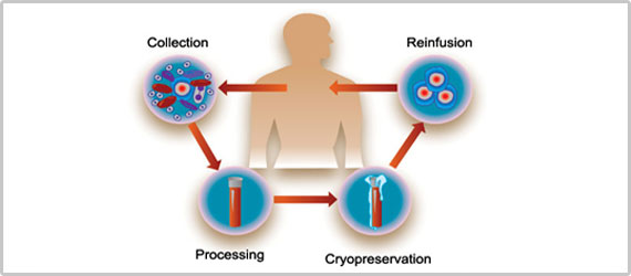 Bone Marrow stem cells